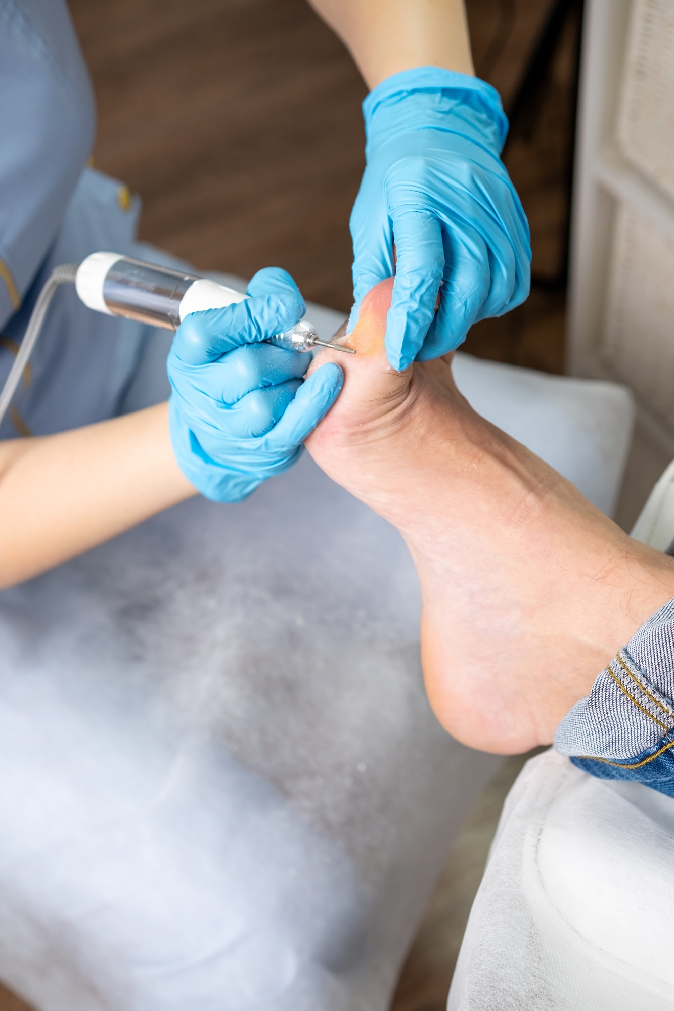 Inicio 1 Close up callus removal from a woman's foot is performed by a podiatrist using an electric drill.
